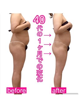 アールズ スリム(R's slim)/本格痩身・痩せるならお任せ！！