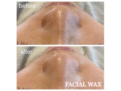 ビアス(VIAS)の写真