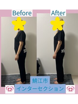 腰の整体インターセクション/美容整体 ビフォーアフター