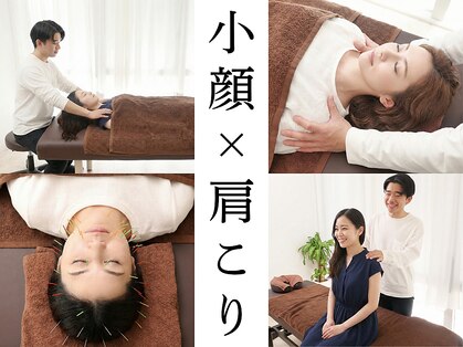 ダズル(DAZZLE)の写真