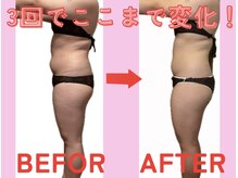 ヨサパーク カリーナ(YOSA PARK carina)