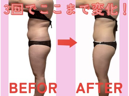 ヨサパーク カリーナ(YOSA PARK carina)の写真