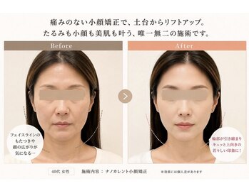 ラウレア(Laule'a)の写真/結果重視の方に◎小顔、たるみケア、ほうれい線、美肌、自律神経でお悩みの方！当店にお任せください♪