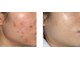 キムズエステティックサロン(Kim's aesthetic salon)の写真/【本場韓国仕込みの本格技！】皮膚美容師オーナーが贈る【極上フェイシャル&ボディ】で肌も心もリセット◇