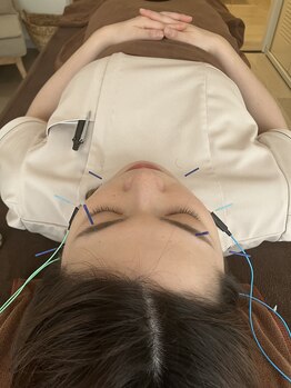 ハリファ鍼灸院 横浜関内院(HariFa鍼灸院)/美容施術