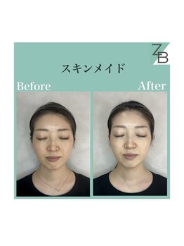 ザラハビューティー(ZARAHA Beauty)/スキンメイド