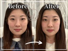 R-1ビューティーサロン 銀座/Before＆After