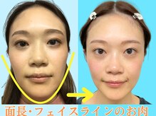 ナチュラルビューティーフェイス 横浜(NBF)