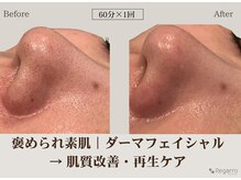 レガロビューティクリエイションズ桜川店の雰囲気（繰り返す肌悩みに。本気の肌質改善で理想の素肌へ。）