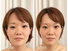 【バストアップ・小顔専門サロン】Cocon Priveの雰囲気(骨格の歪みから整え引き上がったフェイスラインへ☆)