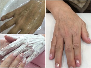 シャンネイルケアサロン(Shan Nail caresalon)/気になるお肌のくすみ