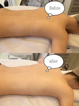 シュシュ(Chou Chou)/☆バックトリートメント☆¥4,500