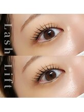 アネラ(ANELA)/パリジェンヌラッシュリフト