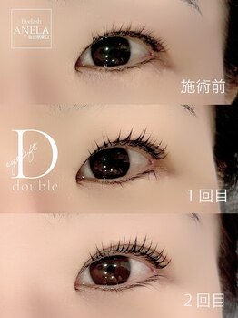 アネラ 仙台駅東口店(ANELA)/ダブルアイリフト