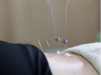 わくわく整骨院/施術風景