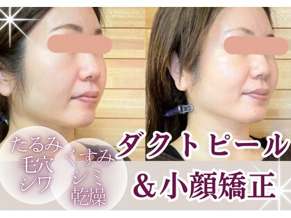 ハナハナ(hanahana)の写真