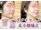 ハナハナ(hanahana)の写真