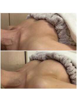 エレナ 伊勢崎(Ele'na)/産後のバストも◎