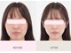 サン(SUN)の写真
