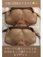 マイントゥー(mine too)/