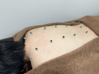 あとらす整体院 小岩店/あったか!