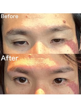 眉毛ハウス 吉祥寺店(眉毛HOUSE)/お客様の施術例(吉祥寺/東京)