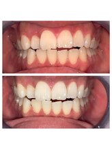 ライトビューティー 池袋店(LightBeauty)/症例写真