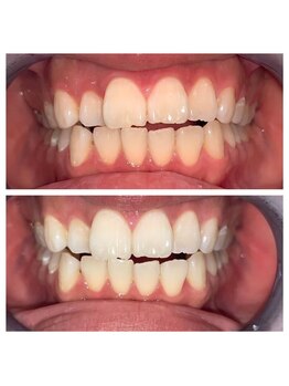 ライトビューティー 池袋店(LightBeauty)/症例写真