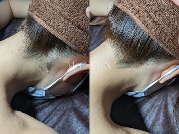 ムーン 横浜(MOON)/【自己処理するより専門店で♪】