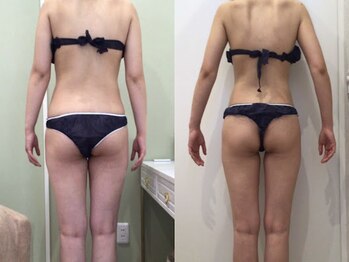 ビラ 銀座店(BILA)/キャビラジ