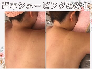 マリスステラ 天王寺(MarisStella)/シェービングでうなじ背中に自信