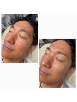 ミセレルオカザキ(MISEREL OKAZAKI)/