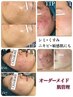 ご新規様限定【あなた専用！完全オーダーメイド美肌プログラム】