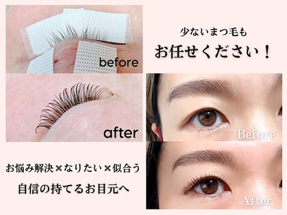 リム(Lim)の写真