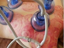 アロマリラクゼーション ミモザの雰囲気（《カッピング》強力な自動吸引でガチガチの背中をほぐします）