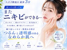 ウェリナベル(WelinaBelle)