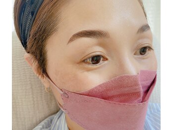 ニコプラス(nico+)/ブロウリフト