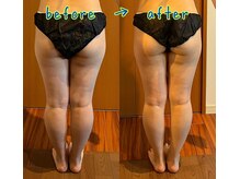 クレール(Claire)/むくみ・疲れを取りたい！