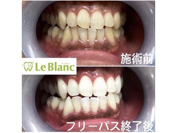 ルブラン 奈良店(Le Blanc)/毎日でも問題無し！！
