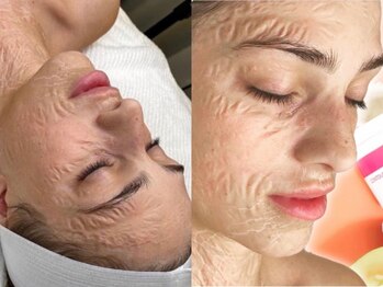 リラクゼーションアンドビューティーボヌール(BONHENR)/ゾンビマスク