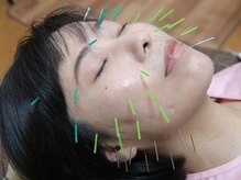 ほがら鍼灸マッサージ