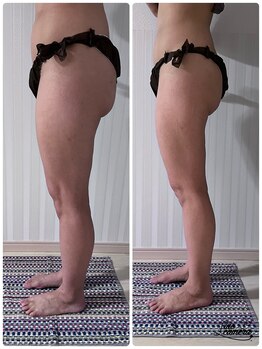 アイナ(aina)/前ももの張り、スッキリ！