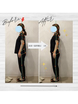 ラクリエ 東加古川院(La Creer)/お客様ビフォーアフター