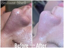 ブリリアント シェル(Brilliant Shell)/徹底☆毛穴洗浄コース《90分》