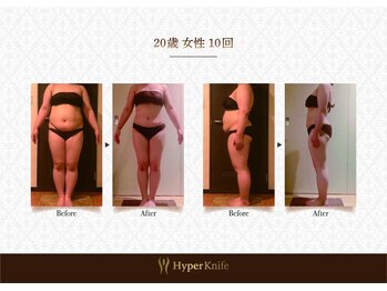 ハンズ鍼灸接骨院小牧院 美容整体ハンズ(美容整体hands)/エステbefore after