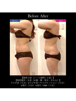 リアン/【痩身/毛穴/たるみケア】