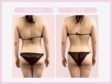 スリムライン 盛岡店(The Slim Line)/before→after