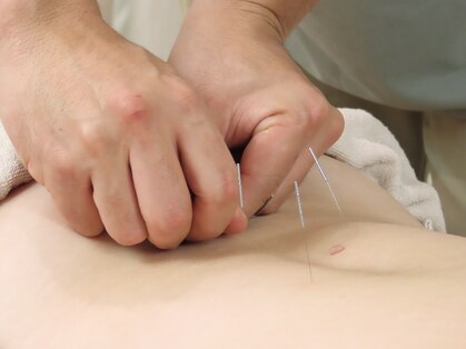 TK鍼灸治療院　[鍼灸/あん摩・マッサージ・指圧/酵素風呂/肩こり/腰痛/産前産後妊活]の写真