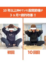 整体院ひなた 都城院/諦めていた股関節不調改善!!都城