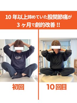 整体院ひなた 都城院/諦めていた股関節不調改善!!都城